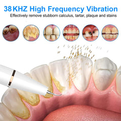 Ultrasonic Dental Scaler For Teeth Tartar Stain Tooth Calculus Remover Electric Sonic Teeth Plaque Cleaner Dental Stone Removal - Top Notch Mart