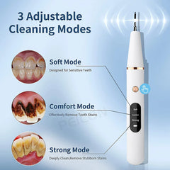 Ultrasonic Dental Scaler For Teeth Tartar Stain Tooth Calculus Remover Electric Sonic Teeth Plaque Cleaner Dental Stone Removal - Top Notch Mart